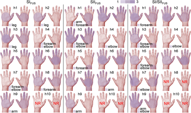 Fig. 2