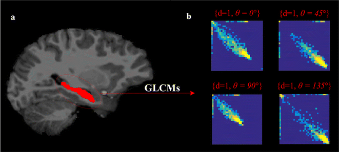 Fig. 3