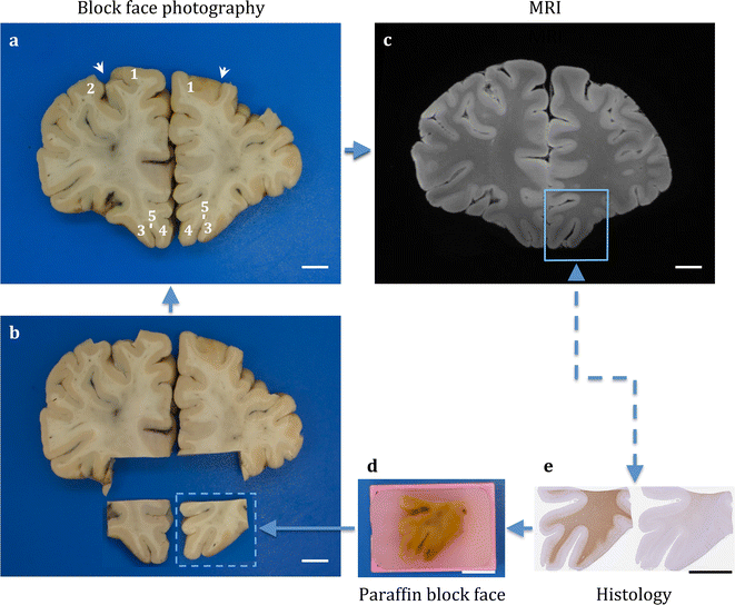 Fig. 1