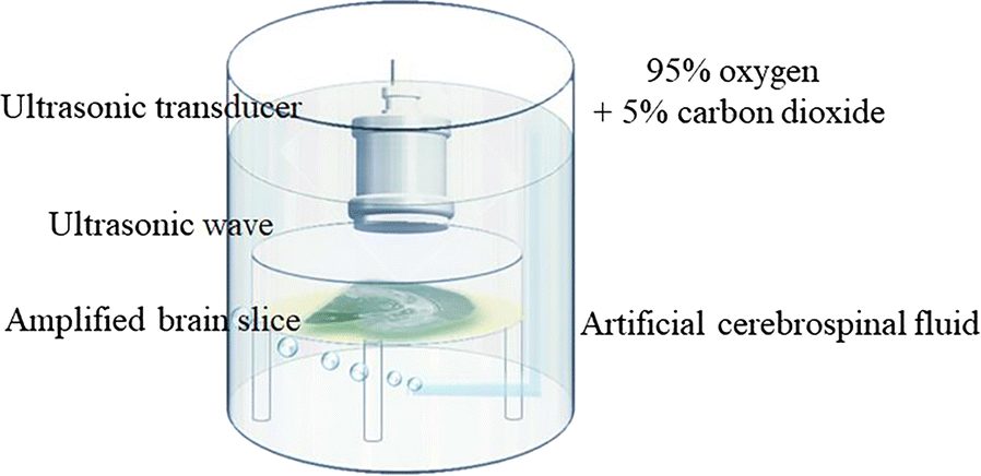 Fig. 1