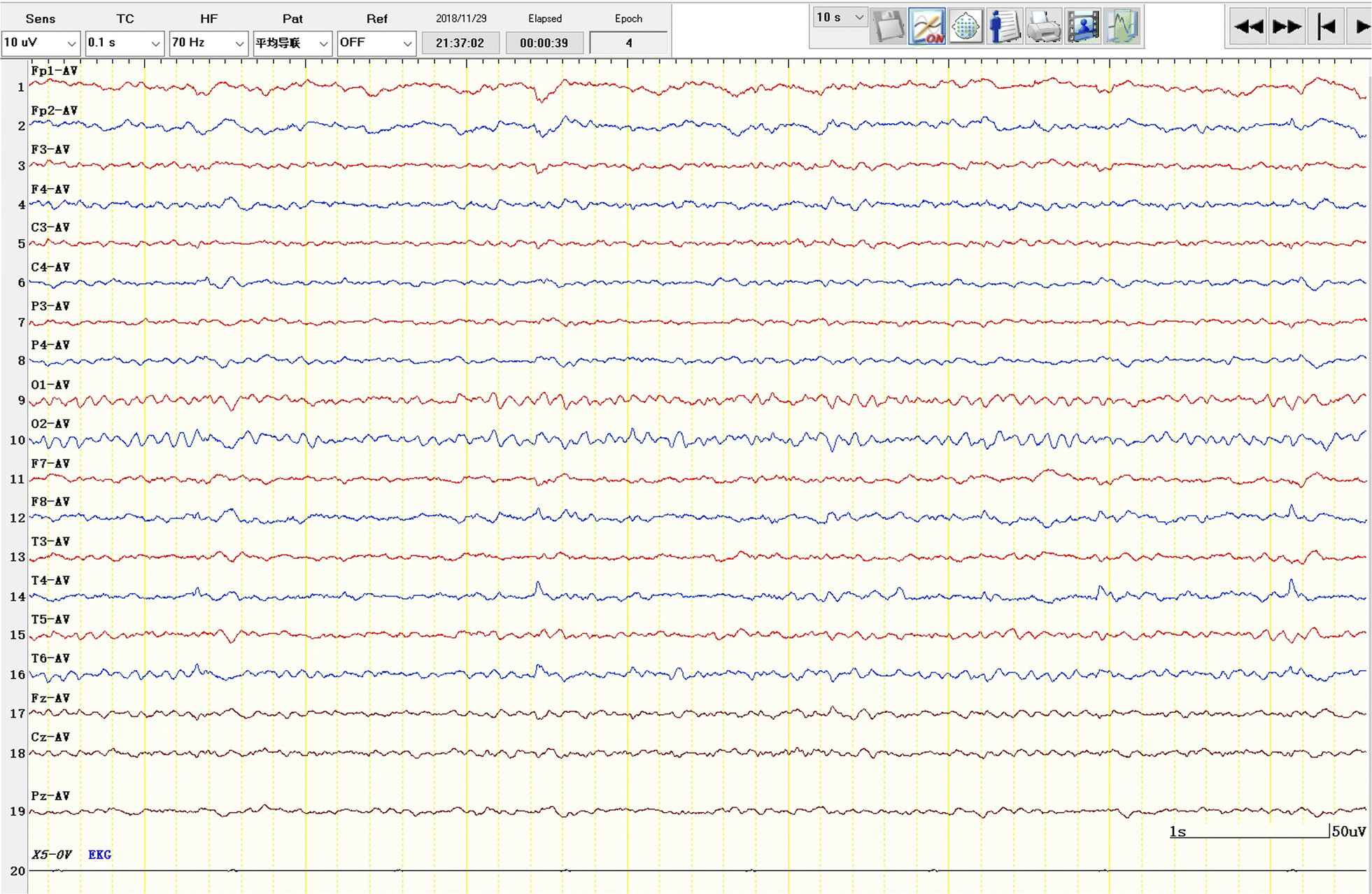 Fig. 2