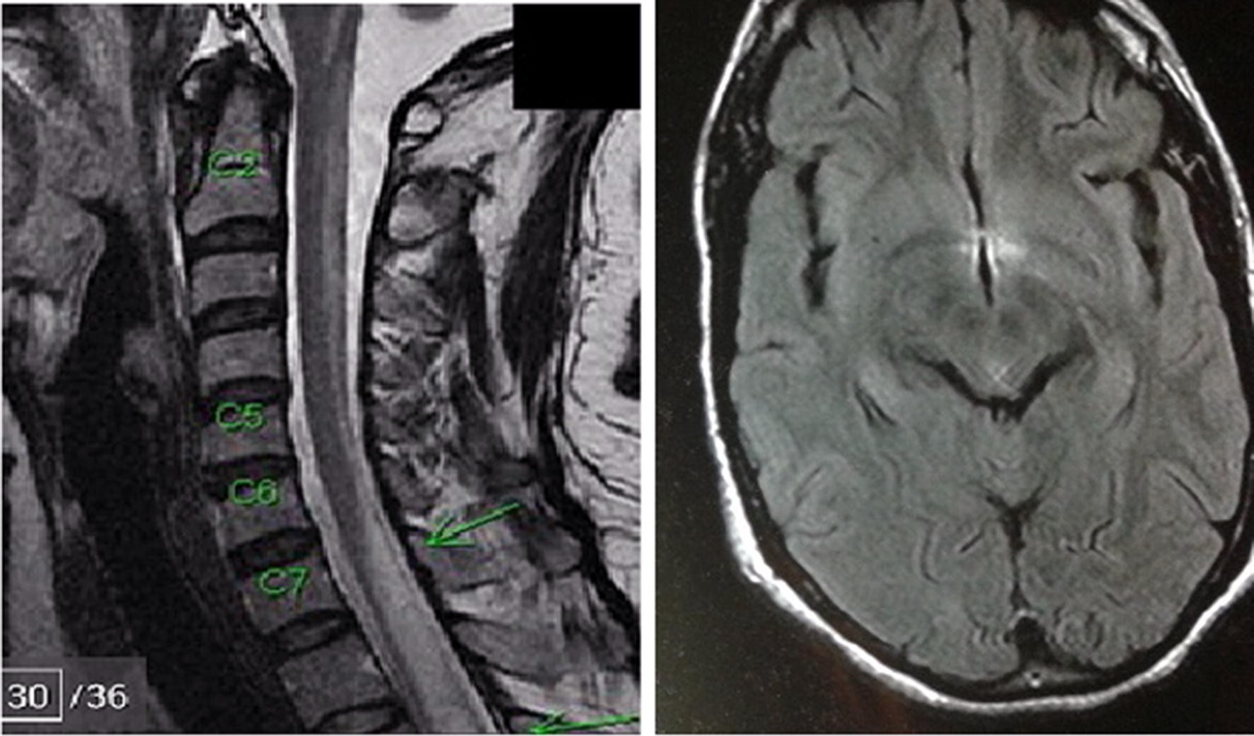 Fig. 2