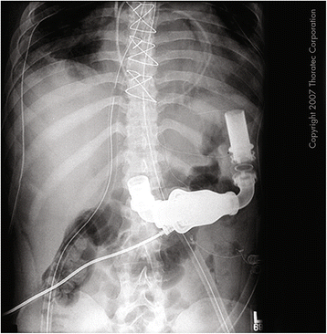 Fig. 3