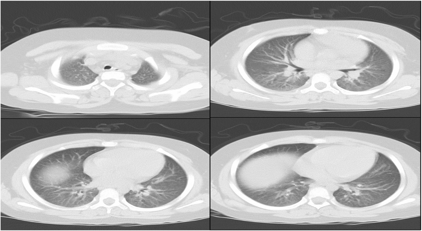 Fig. 2