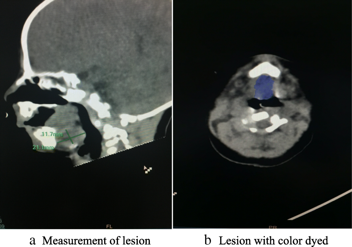 Fig. 2