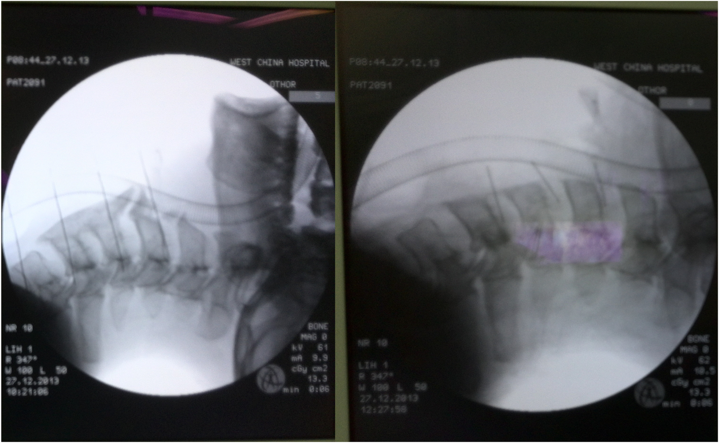 Fig. 3