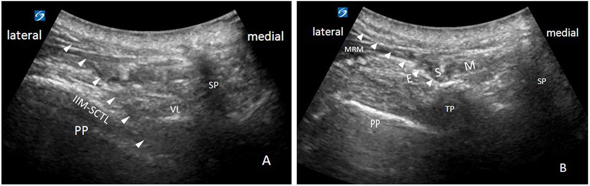 FIG. 1