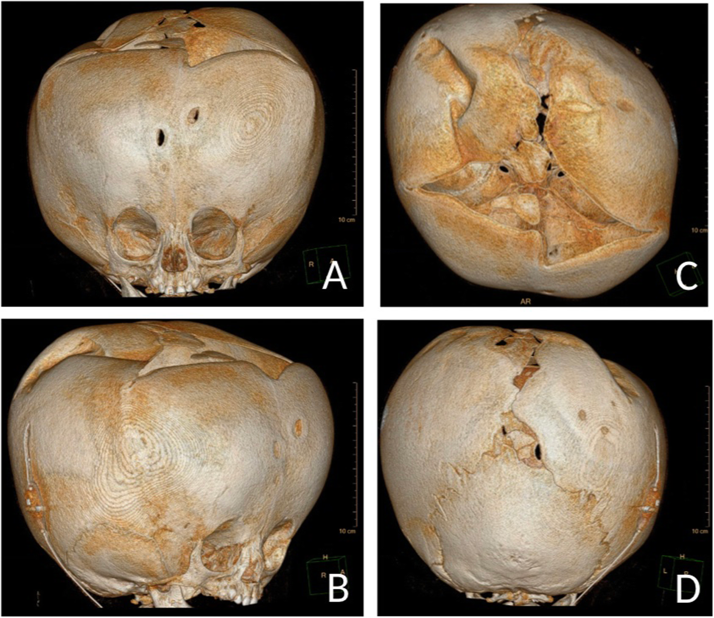 Fig. 2