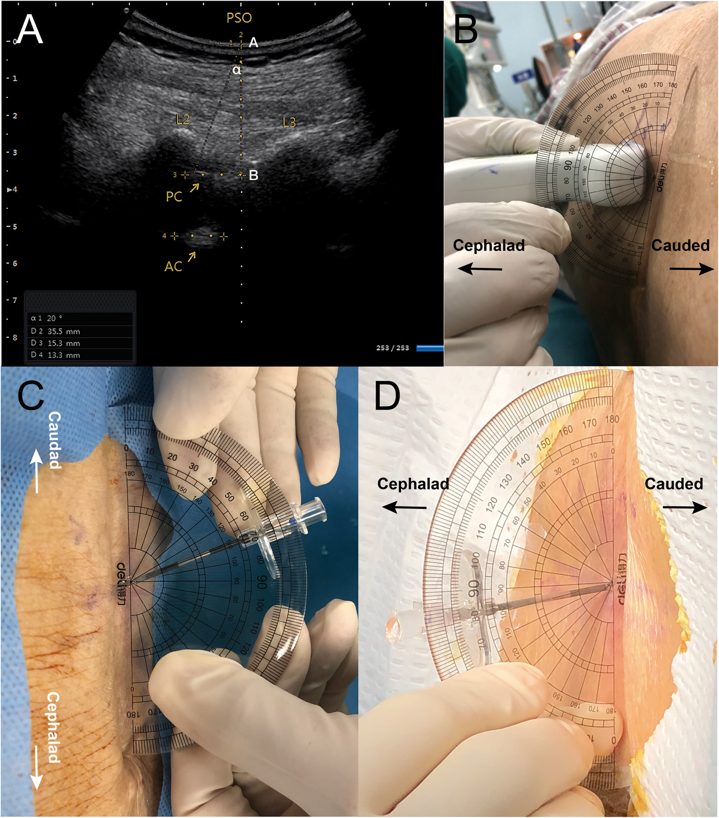 Fig. 2