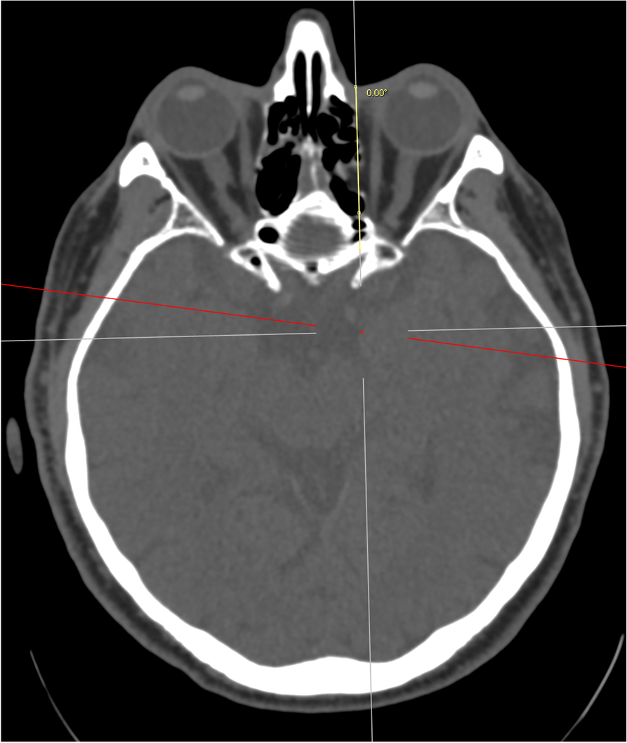 Fig. 1