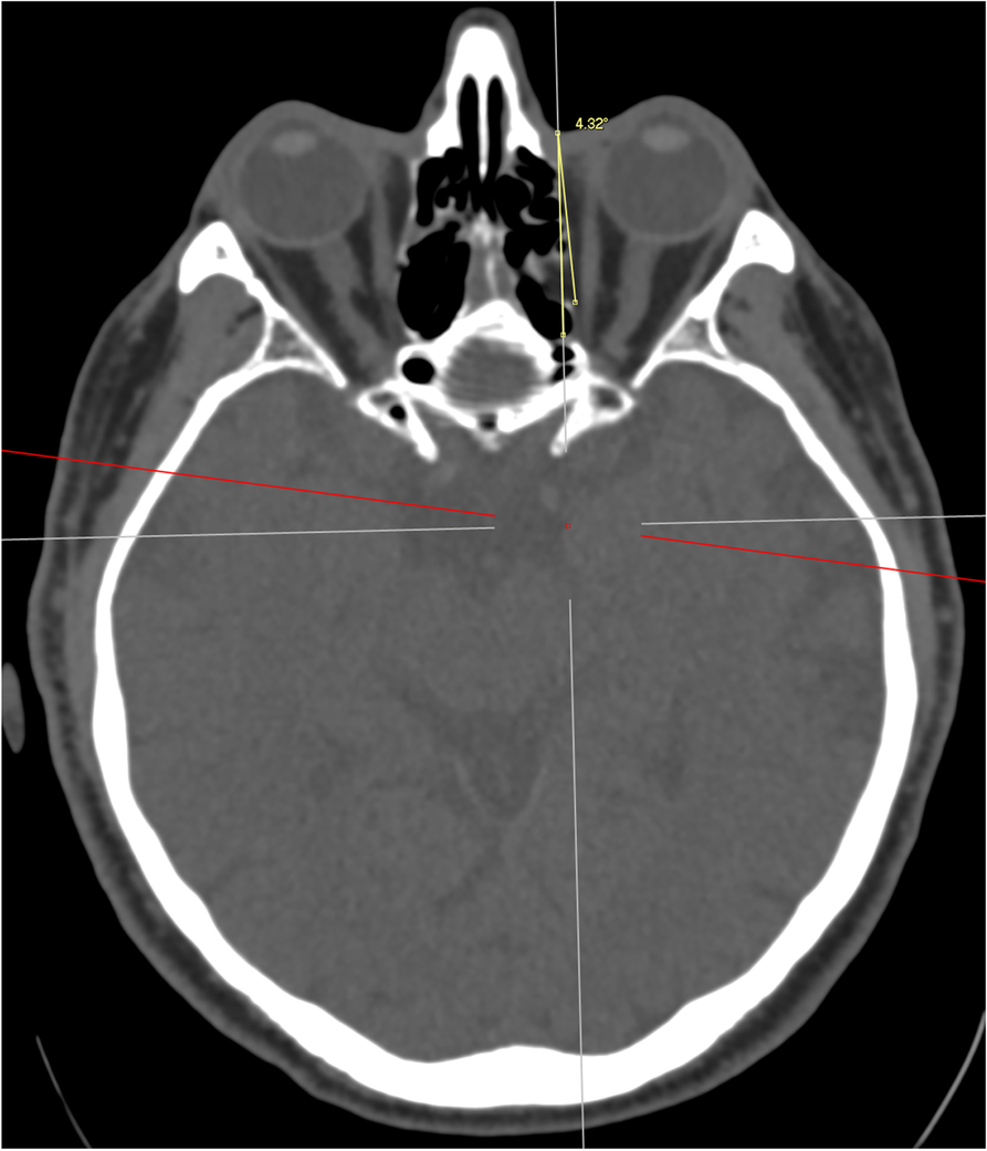 Fig. 2