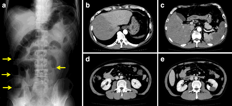 Fig. 1