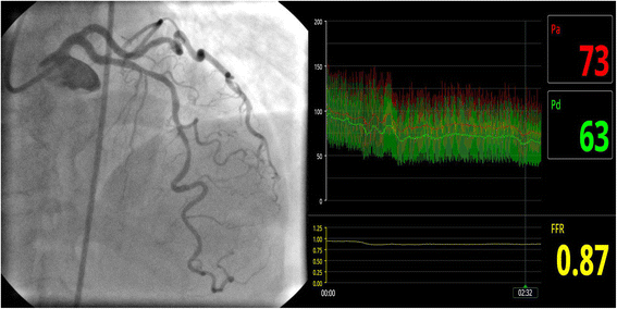 Fig. 2