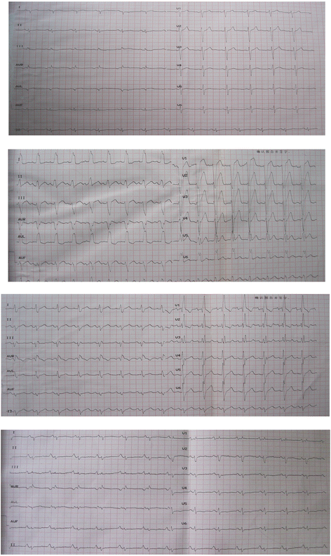 Fig. 1