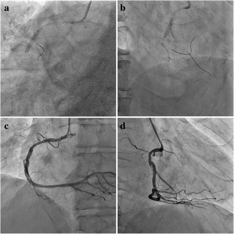 Fig. 4