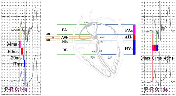 Fig. 2