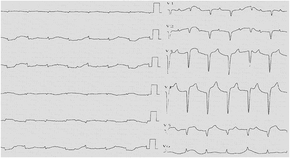 Fig. 6