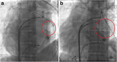 Fig. 4