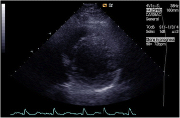 Fig. 5