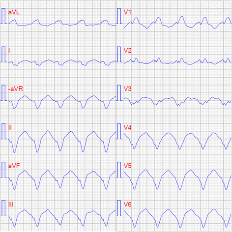 Fig. 6