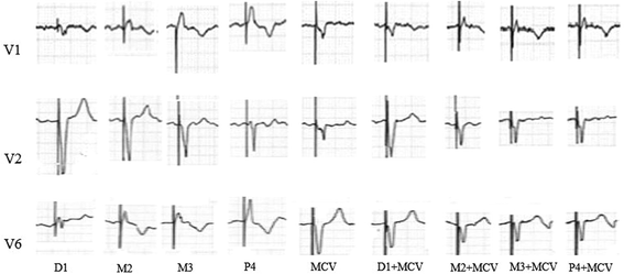 Fig. 2