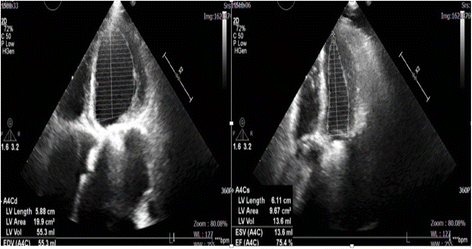 Fig. 3