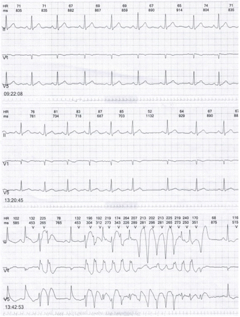 Fig. 12