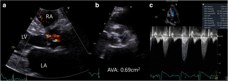 Fig. 2