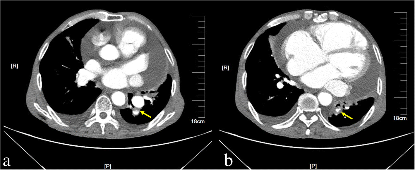 Fig. 5