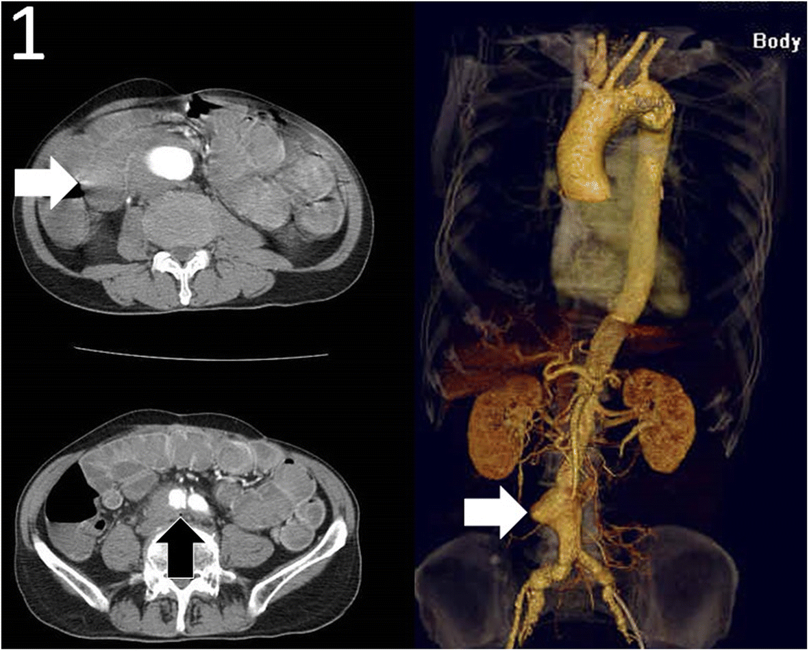 Fig. 1