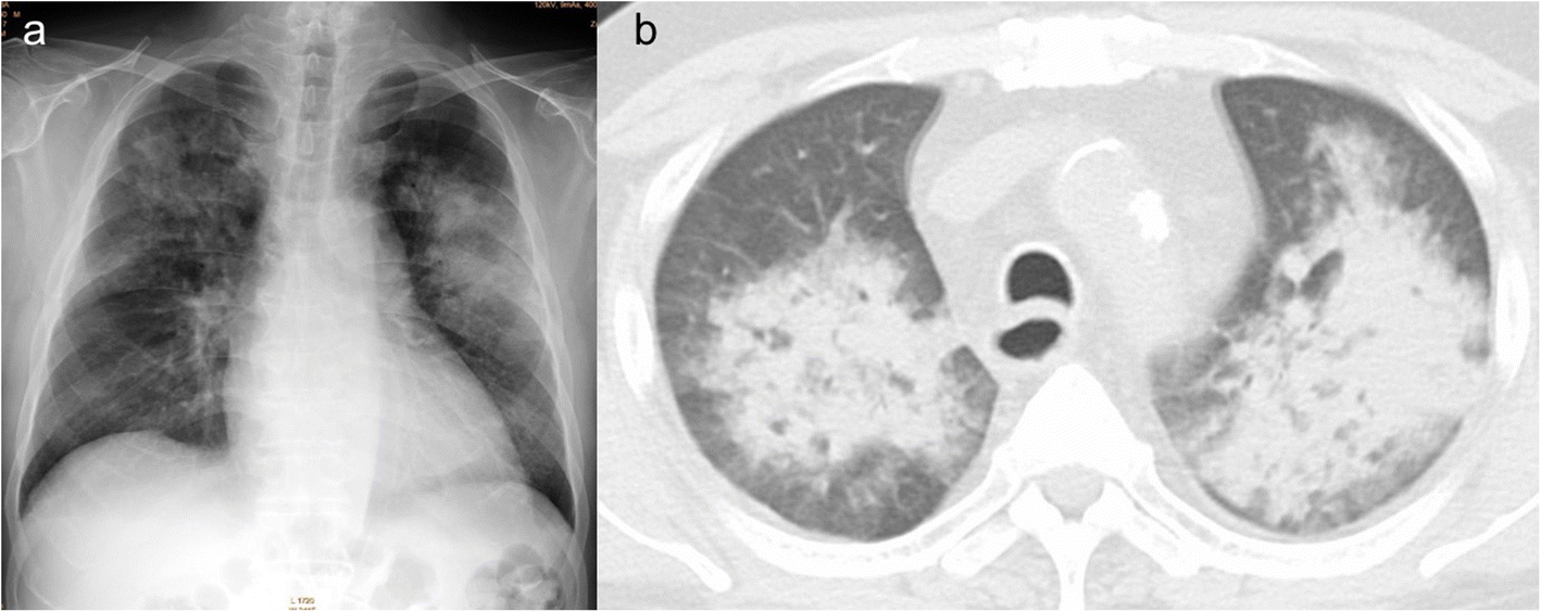 Fig. 1