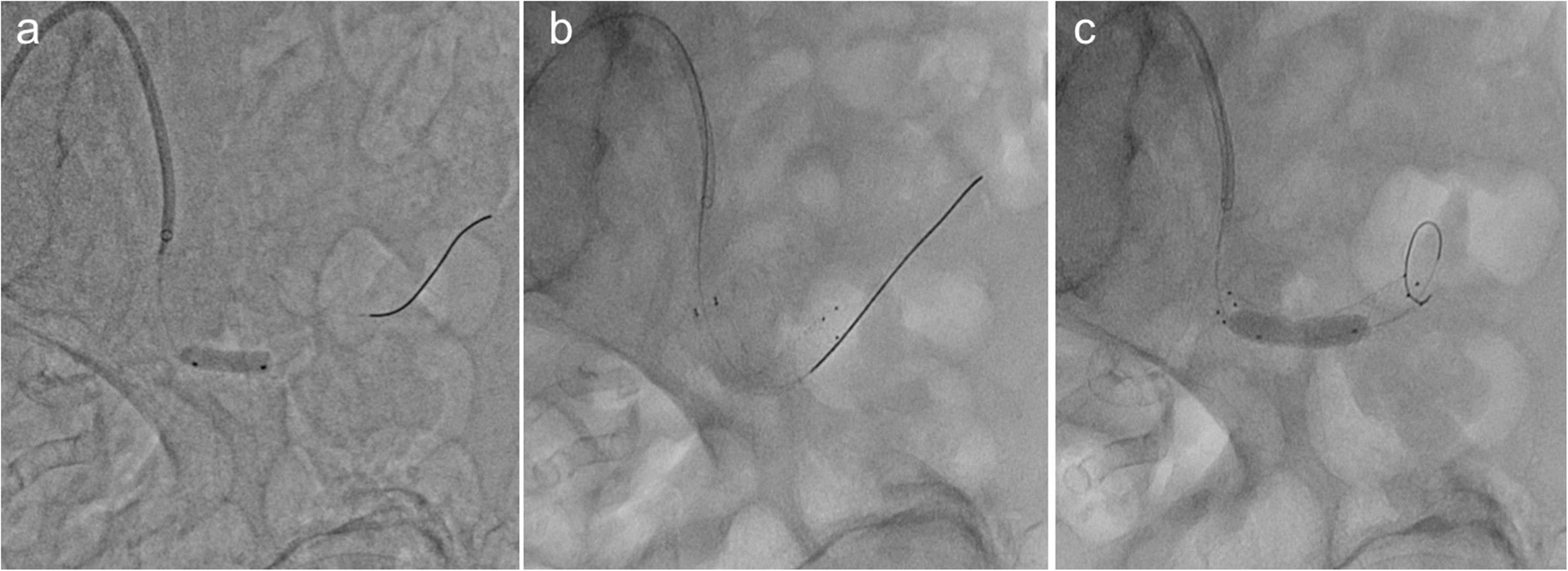 Fig. 5