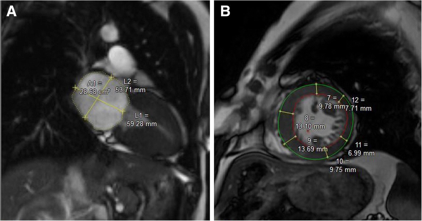 Fig. 2