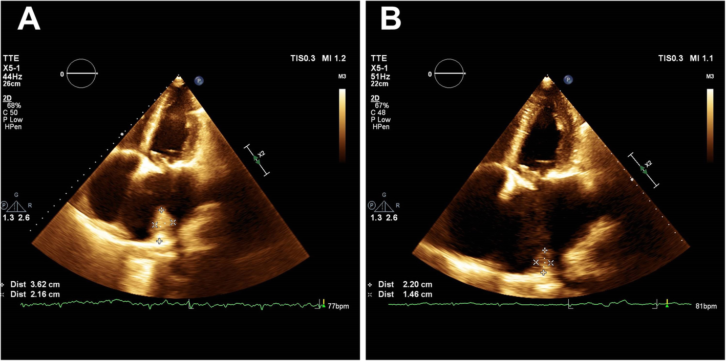 Fig. 4