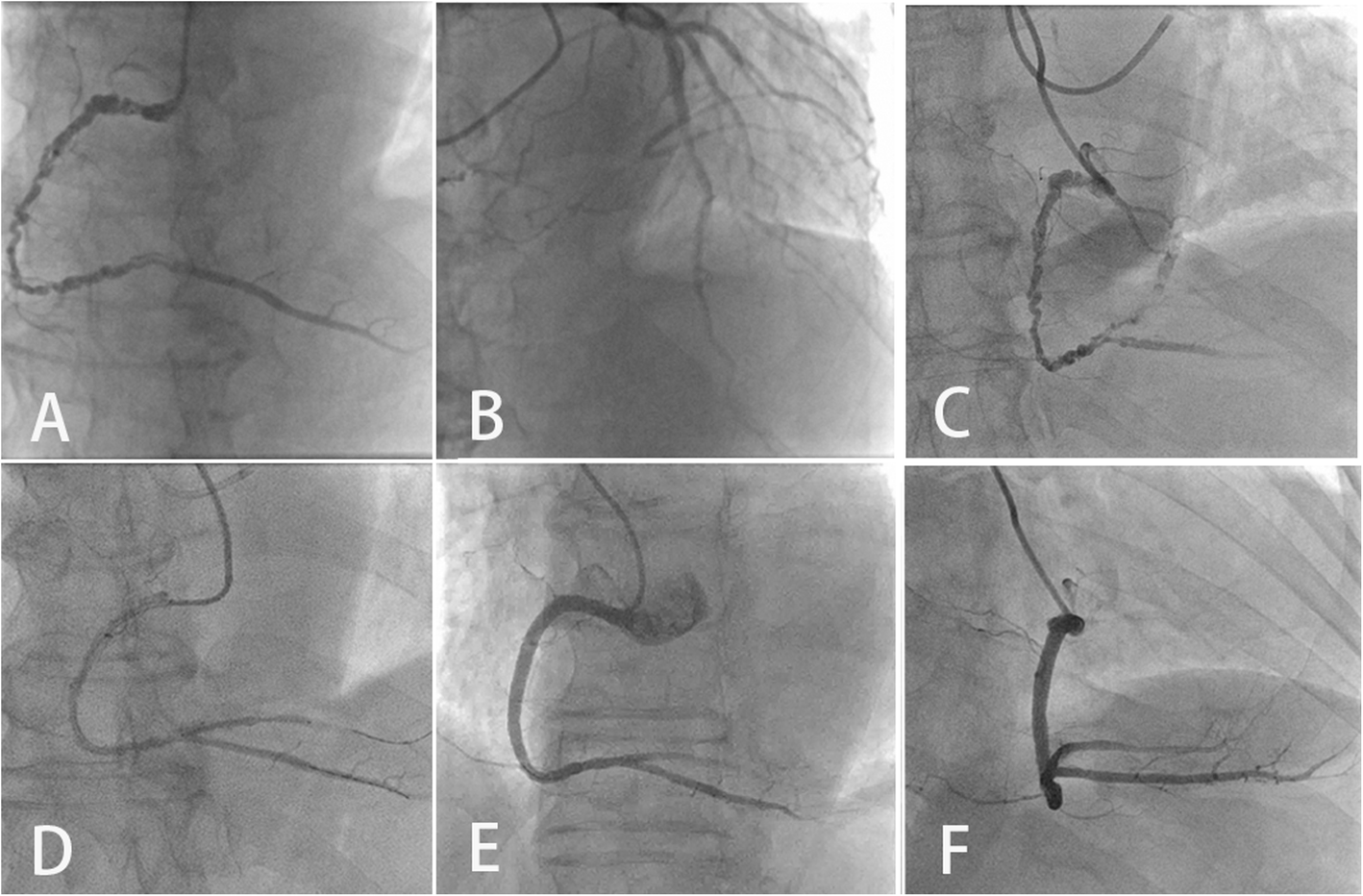 Fig. 2