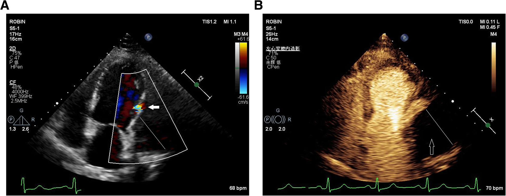 Fig. 4