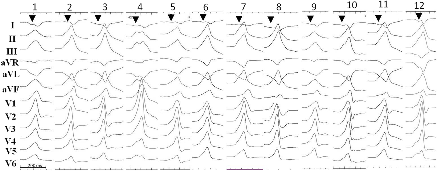 Fig. 2