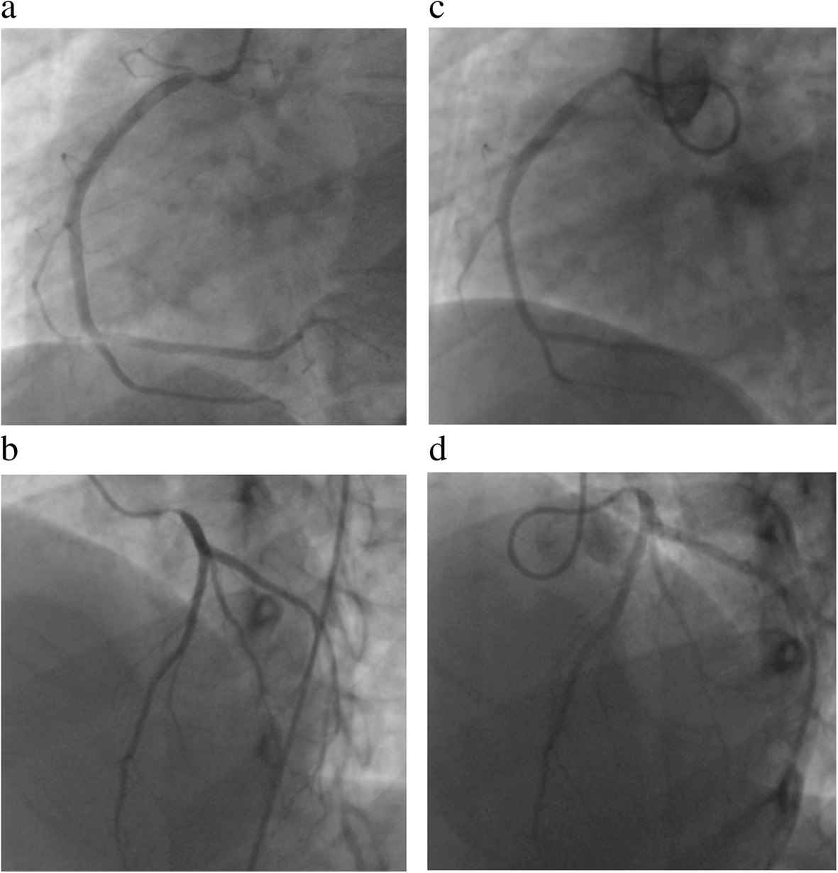 Fig. 2