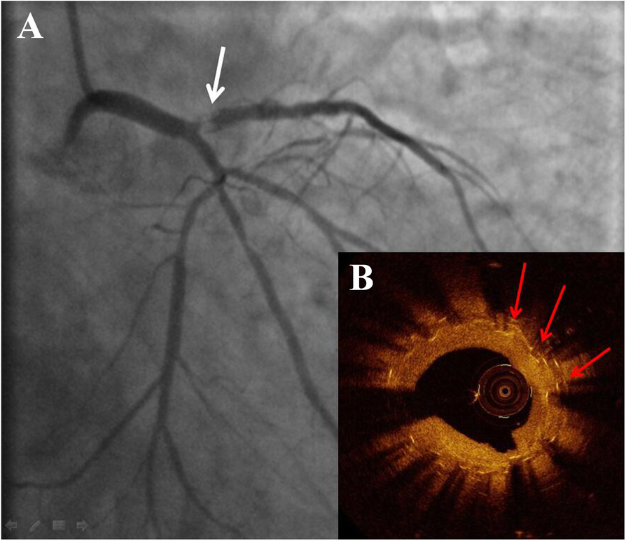 Fig. 2