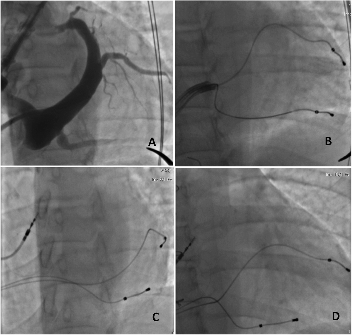 Fig. 1