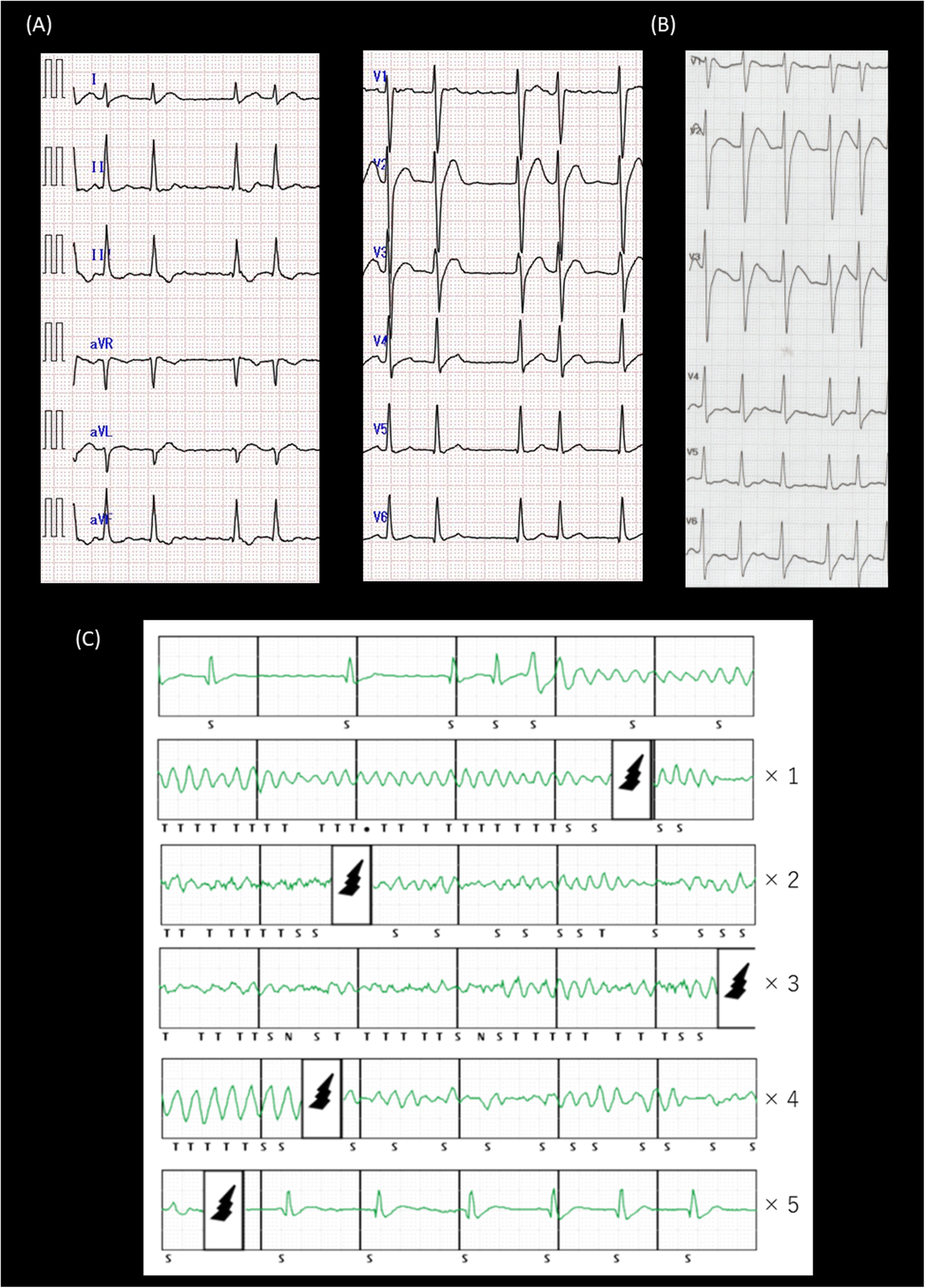 Fig. 1