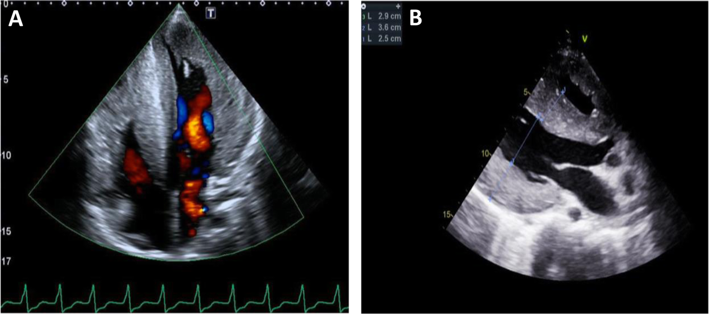 Fig. 2