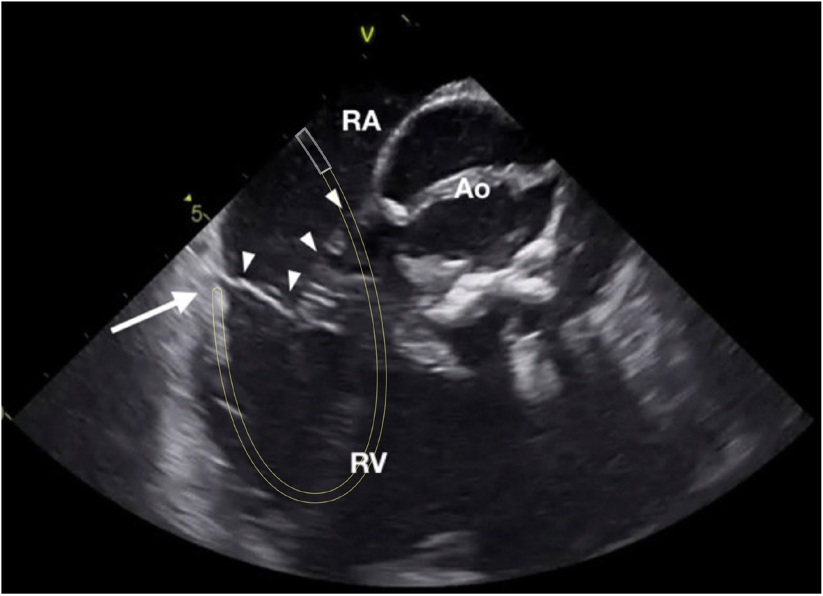 Fig. 5