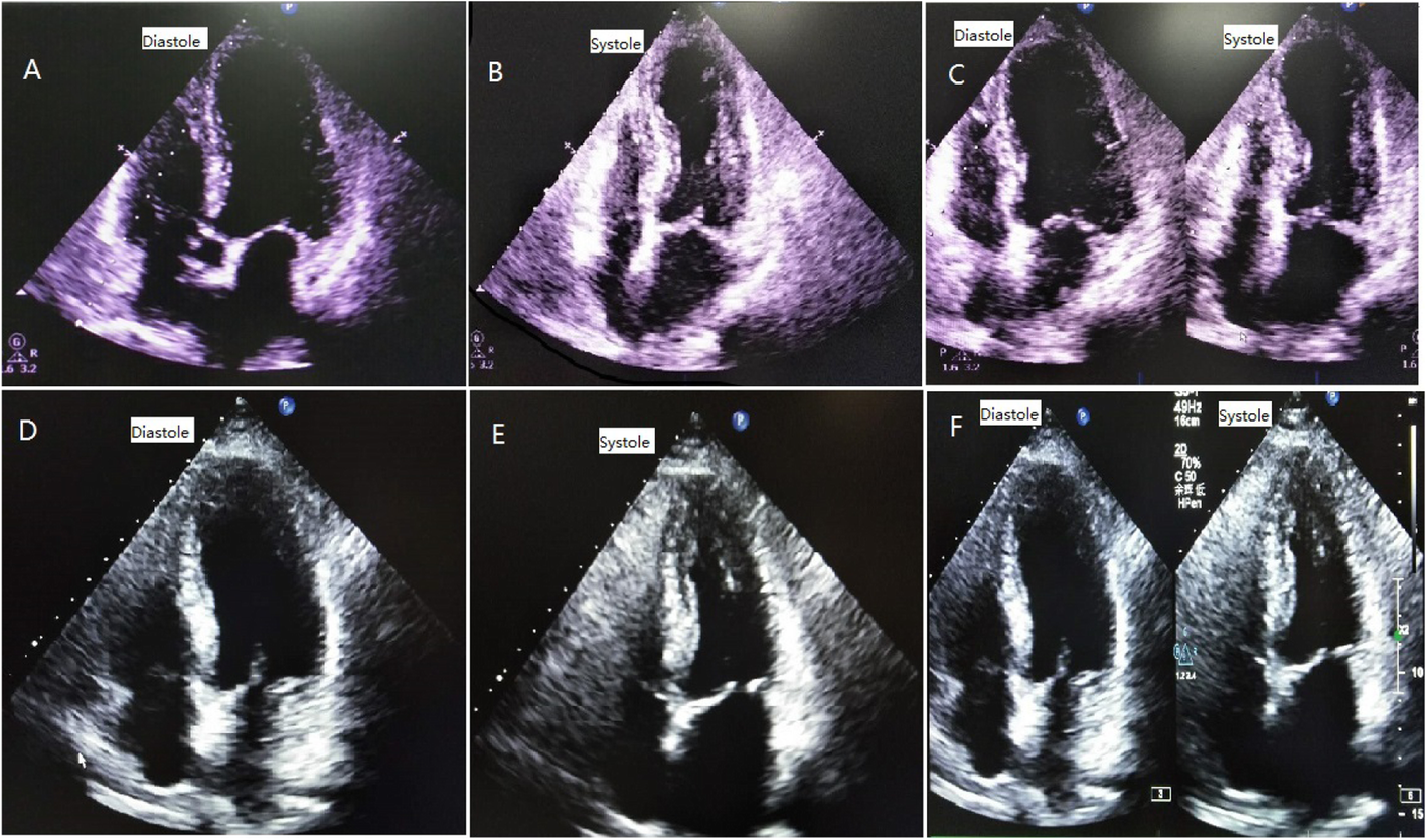 Fig. 4