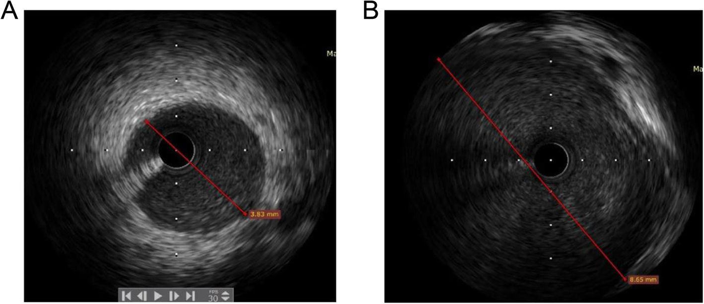 Fig. 4