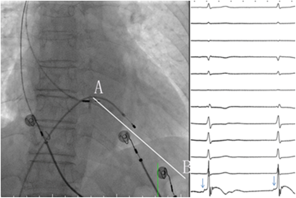 Fig. 2