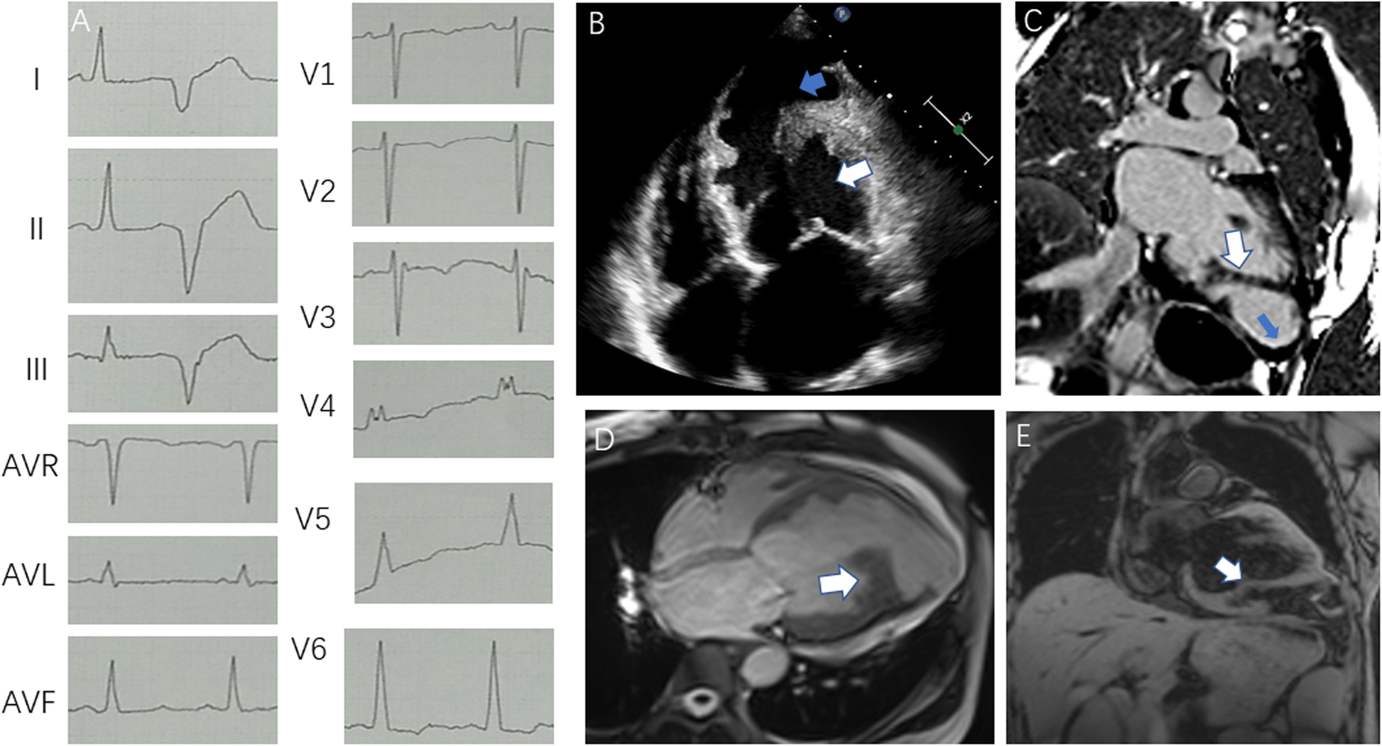 Fig. 2