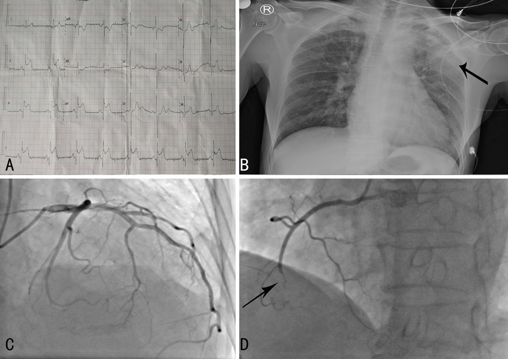 Fig.1