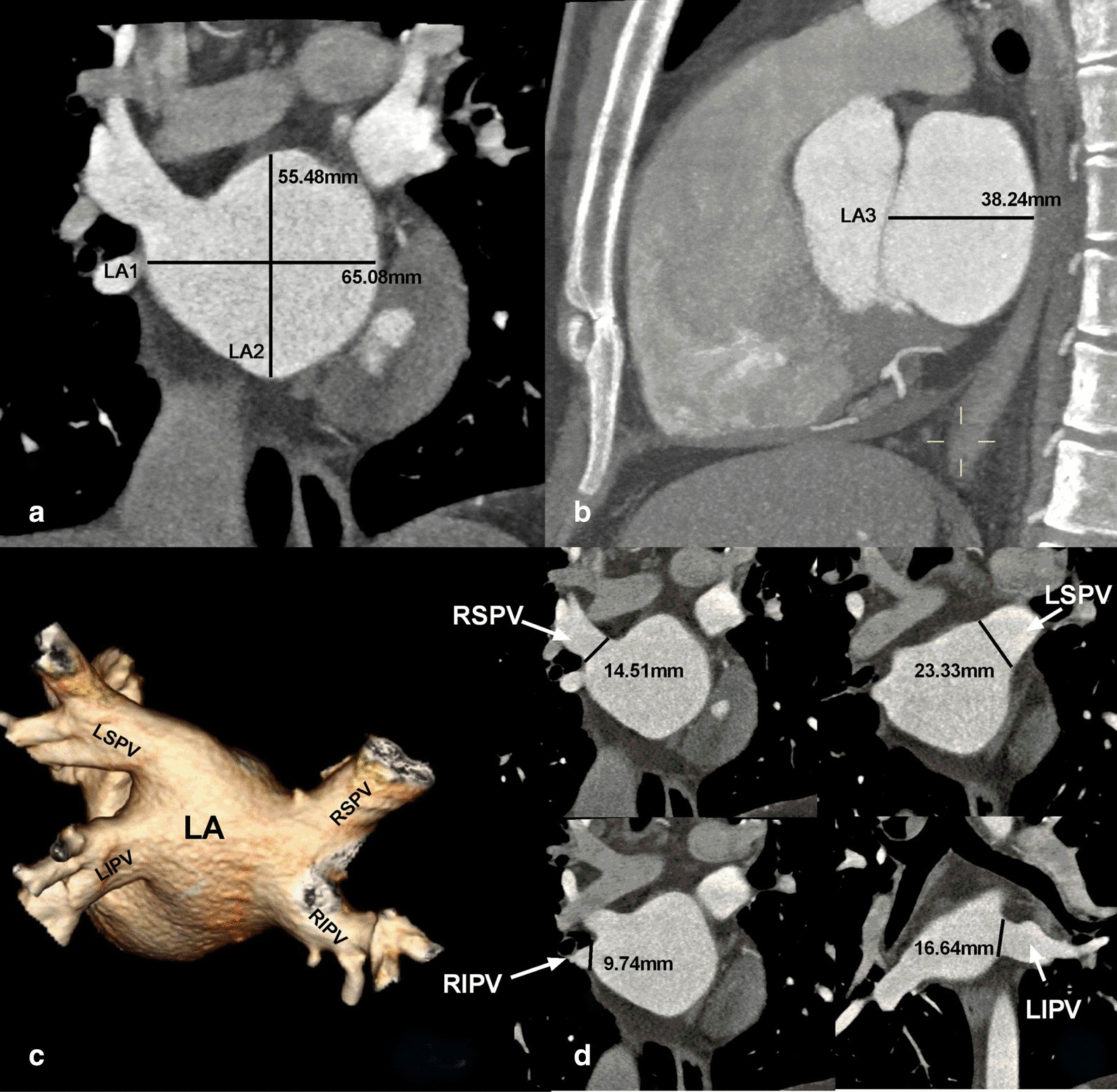 Fig. 2