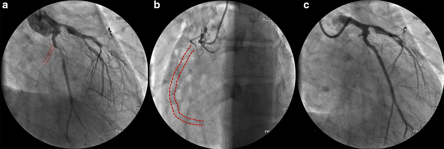 Fig. 5